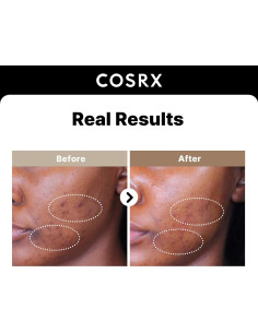 Suero Facial COSRX 2% Alpha Arbutin 50 ml - Cuidado de Manchas 2
