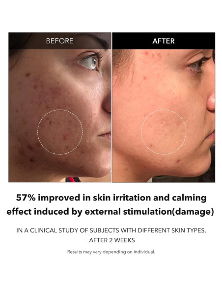 Suero Facial Aclarador APRILSKIN Carrotene 37ml Vegano Suero Facial Aclarador APRILSKIN Carrotene 37ml Vegano