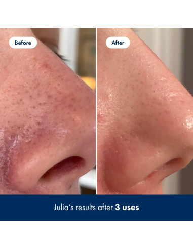 Tónico Exfoliante Hero Cosmetics 100 ml con Ácido Salicílico