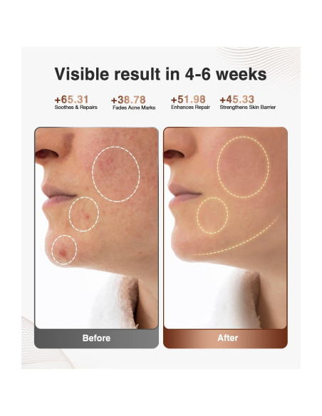 Máscara de Terapia de Luz Roja JOVS para la Cara - 4 Modos Máscara de Terapia de Luz Roja JOVS para la Cara - 4 Modos