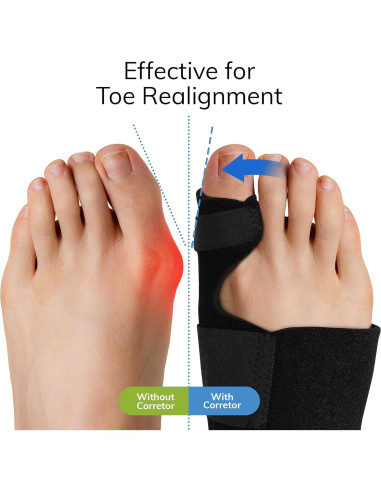Corrector de Juanetes Fittest Pro - Splint Ortopédico 2 Piezas