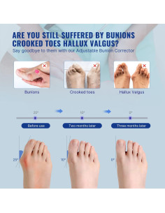 Corrector de Juanetes Fit Geno Unisex Ajustable 2 Pcs 2