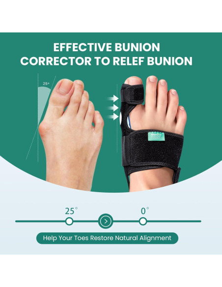 Corrector de Juanetes Welnove para Hombres y Mujeres - 1 Par Corrector de Juanetes Welnove para Hombres y Mujeres - 1 Par