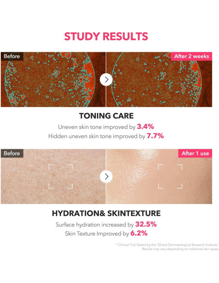Tónico Lechoso Rosa APRILSKIN 150ml TXA 3% Niacinamida 5% Tónico Lechoso Rosa APRILSKIN 150ml TXA 3% Niacinamida 5%