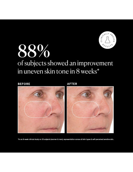 Suero Facial Naturium Vitamina C 28.35 g con Retinol y Ácido Hialurónico Suero Facial Naturium Vitamina C 28.35 g con Retinol y Ácido Hialurónico
