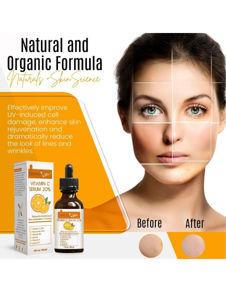 Suero Facial Vitamina C 20% Dermaxgen 30 ml - Antiarrugas Suero Facial Vitamina C 20% Dermaxgen 30 ml - Antiarrugas