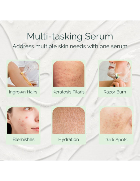 Suero Exfoliante Serious para Vellos Encarnados - 28g Suero Exfoliante Serious para Vellos Encarnados - 28g