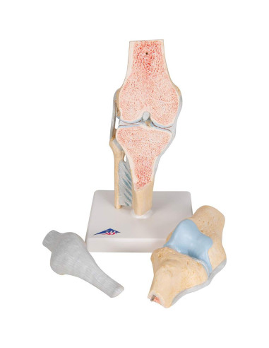 Modelo de Articulación de Rodilla Seccional 3B Scientific A89