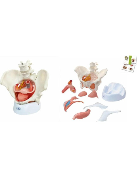 Modelo Anatómico de Pelvis Femenina Wellden 6 Partes 1.65kg Modelo Anatómico de Pelvis Femenina Wellden 6 Partes 1.65kg