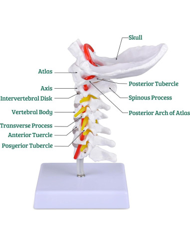 Modelo de Columna Cervical Ultrassist a Tamaño Real para Educación Médica