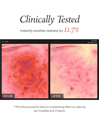 Limpiador Facial Aprilskin Aloe Rosa 189g Exfoliante Suave