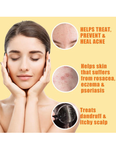 Barra de Jabón de Azufre 10% Natrulo - Limpiador Facial Natural 2