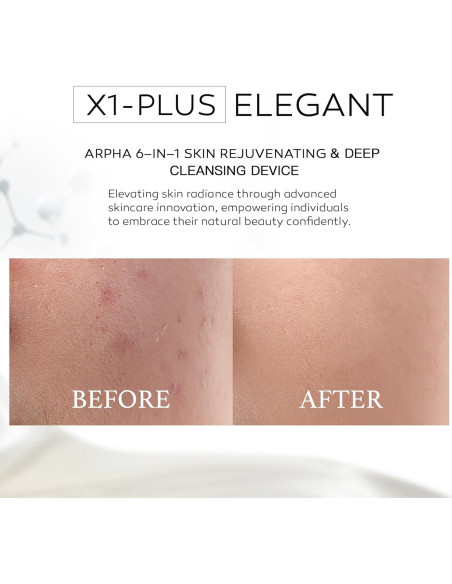 Exfoliador Facial Sónico Arpha X1-plus Negro, Limpieza Profunda Exfoliador Facial Sónico Arpha X1-plus Negro, Limpieza Profunda