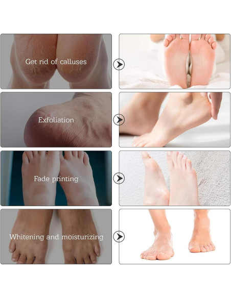 Mascarilla Exfoliante para Pies Dr.Pedi - 5 Pares Lavanda Mascarilla Exfoliante para Pies Dr.Pedi - 5 Pares Lavanda