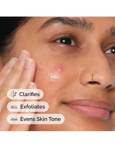 Suero Exfoliante Suave DECIEM 30 ml x 2 - Ácido Salicílico 2%