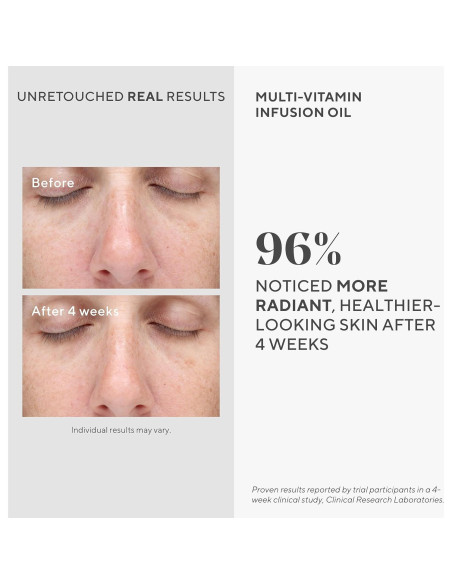 Aceite Facial Multi-Vitaminas Murad 28.35 g - Hidratante Antienvejecimiento Aceite Facial Multi-Vitaminas Murad 28.35 g - Hidratante Antienvejecimiento