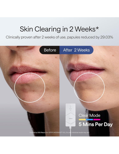 Máscara de Terapia de Luz LED Ulike ReGlow 272 Perlas 100W