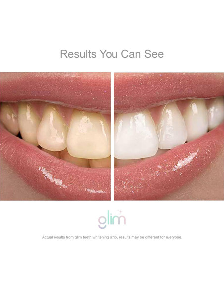 Tiras Blanqueadoras de Dientes Glim - 42 Tiras (21 Tratamientos) Veganas Tiras Blanqueadoras de Dientes Glim - 42 Tiras (21 Tratamientos) Veganas