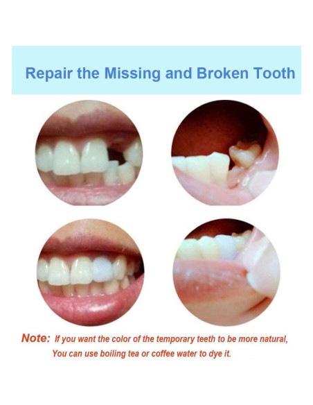 Perlas Térmicas Brige para Relleno Dental - 1000 Perlas Perlas Térmicas Brige para Relleno Dental - 1000 Perlas