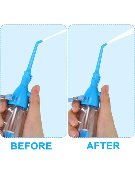 Irrigador Oral Manual Patelai 75ml Portátil Azul para Dientes Irrigador Oral Manual Patelai 75ml Portátil Azul para Dientes