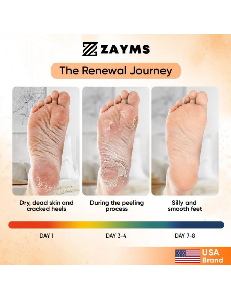 Mascarilla Exfoliante para Pies ZAYMS - 5 Paquetes, Suaves y Renovados Mascarilla Exfoliante para Pies ZAYMS - 5 Paquetes, Suaves y Renovados