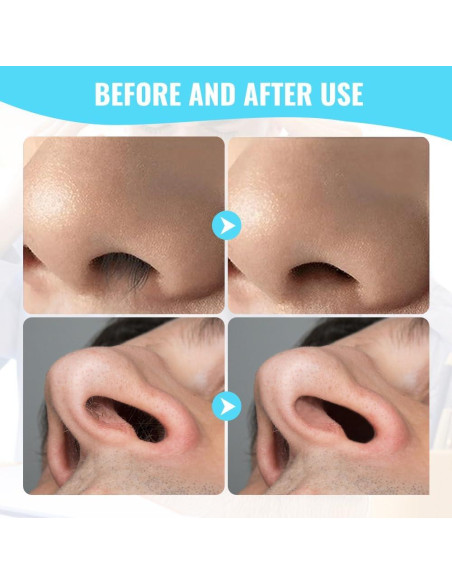 Cortador de Vello Nasal 2 en 1 JUDUNA Doble Cara 3 Pzs Cortador de Vello Nasal 2 en 1 JUDUNA Doble Cara 3 Pzs