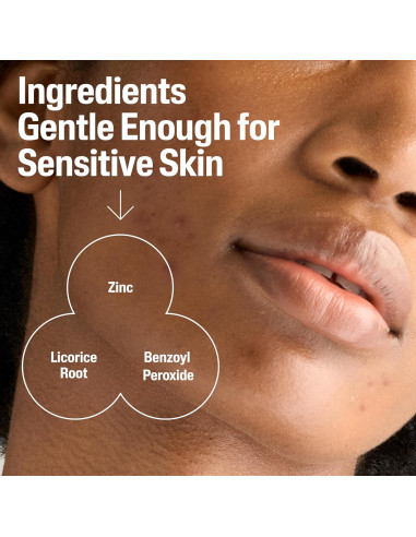 Limpiador de Acné Cetaphil Gentle Clear 119g - Suave para Piel Sensible