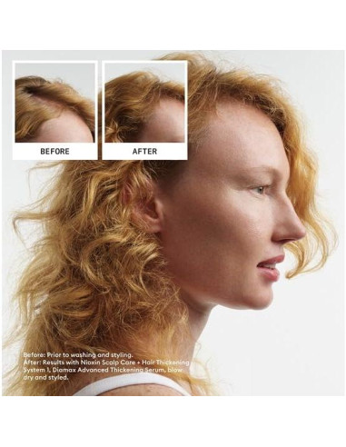 Kit de Engrosamiento de Cabello Nioxin Sistema 1 - 1 Mes