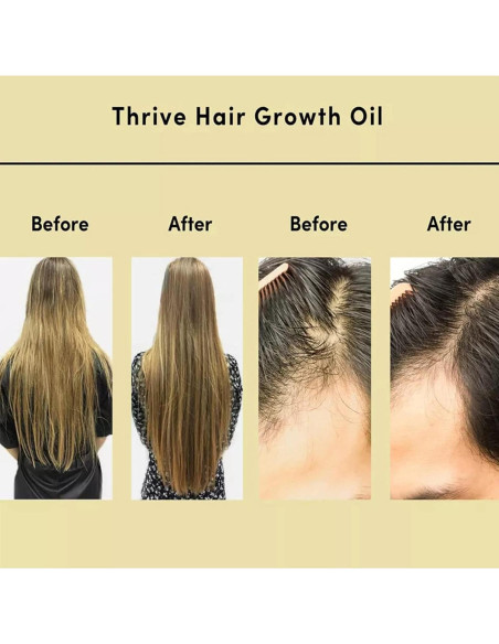Aceite Natural Vegano Carvenchi 60ml para Crecimiento Cabello Aceite Natural Vegano Carvenchi 60ml para Crecimiento Cabello