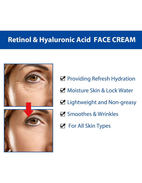 Crema Hidratante Facial GUOYAOLIFU con Retinol y Ácido Hialurónico 85g Crema Hidratante Facial GUOYAOLIFU con Retinol y Ácido Hialurónico 85g