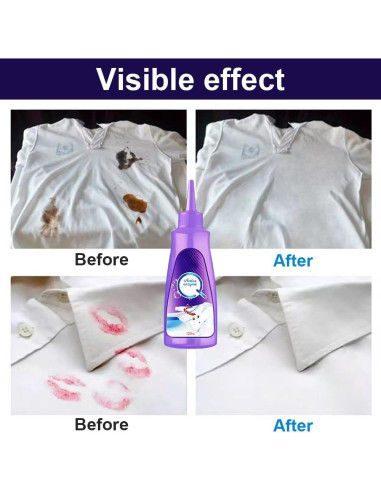Removedor de Manchas de Ropa Yilia 2025 - Enzimas Activas 500ml