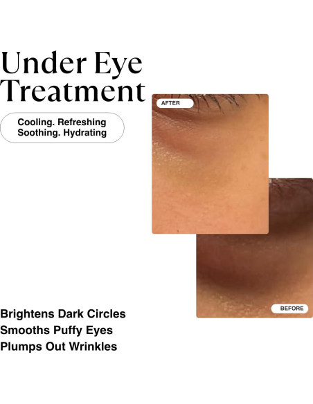 Crema para Ojos Matkas con Vitamina C y Café 15 ml - Antiarrugas Crema para Ojos Matkas con Vitamina C y Café 15 ml - Antiarrugas