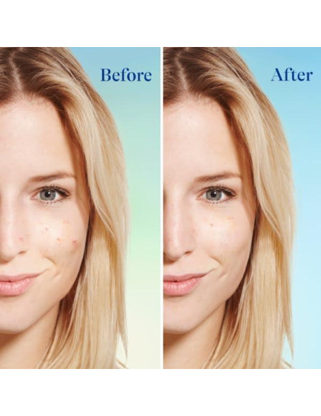 Limpiador Facial Differin 118.3 ml con 5% Peróxido de Benzoilo Limpiador Facial Differin 118.3 ml con 5% Peróxido de Benzoilo