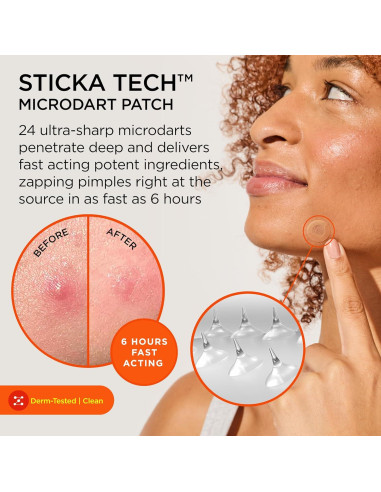 ZitSticka Killa Parches para Acné - 20 Unidades con Microagujas