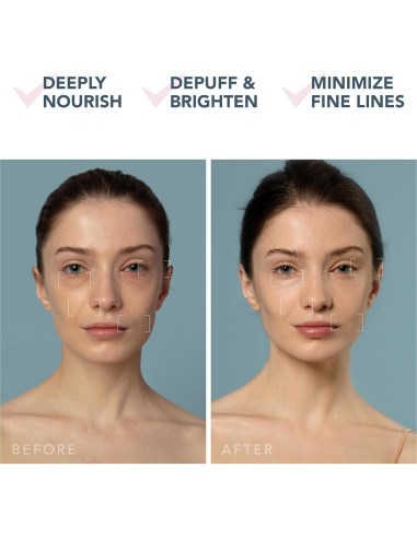 Dispositivo Hidratante Facial FOREO UFO 3 + 14 Máscaras