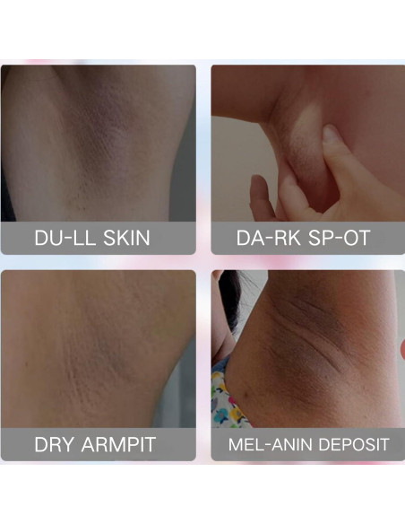Crema Blanqueadora Evolvique para Mujeres - Hidratante y Aclaradora para Axilas y Cuerpo Crema Blanqueadora Evolvique para Mujeres - Hidratante y Aclaradora para Axilas y Cuerpo