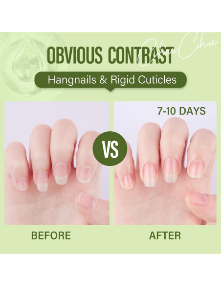 Aceite para Cutículas CHUCHU 15ml Jojoba Aloe Vera Hidratante Aceite para Cutículas CHUCHU 15ml Jojoba Aloe Vera Hidratante