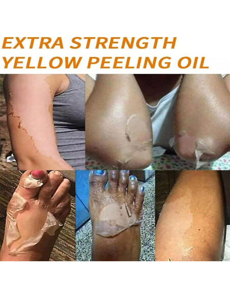 Aceite Exfoliante Amarillo Genérico 110ml para Todo Tipo de Piel Aceite Exfoliante Amarillo Genérico 110ml para Todo Tipo de Piel