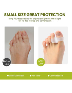 Separadores de Dedos Bukihome para Juanetes - 8 Piezas 2