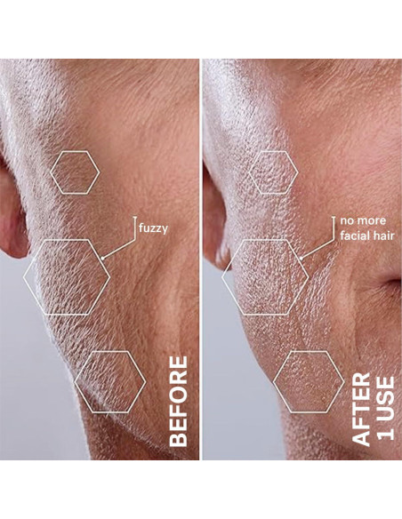 Recortador de Cejas Michael Todd Beauty Sonicsmooth - Dermaplaning Recortador de Cejas Michael Todd Beauty Sonicsmooth - Dermaplaning