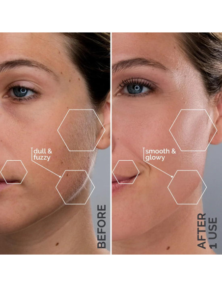 Recambios Cuchillas Dermaplaning Michael Todd Beauty - 8 Unidades Recambios Cuchillas Dermaplaning Michael Todd Beauty - 8 Unidades