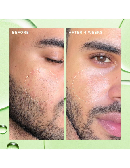Tónico Facial Exfoliante BHA 2% Farmacia 10ml - Piel Grasa Tónico Facial Exfoliante BHA 2% Farmacia 10ml - Piel Grasa