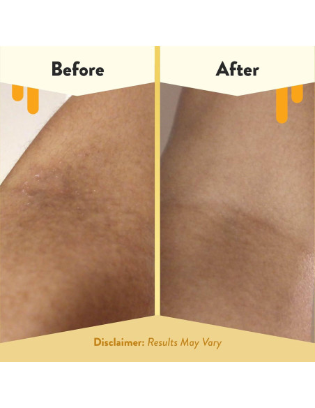 Baño de Burbuja de Avena Eczema Honey 340g - Gel de Ducha Sin Fragancia Baño de Burbuja de Avena Eczema Honey 340g - Gel de Ducha Sin Fragancia