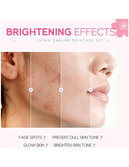 Set de Cuidado Facial 5 Piezas Minfei con Extracto de Sakura Set de Cuidado Facial 5 Piezas Minfei con Extracto de Sakura