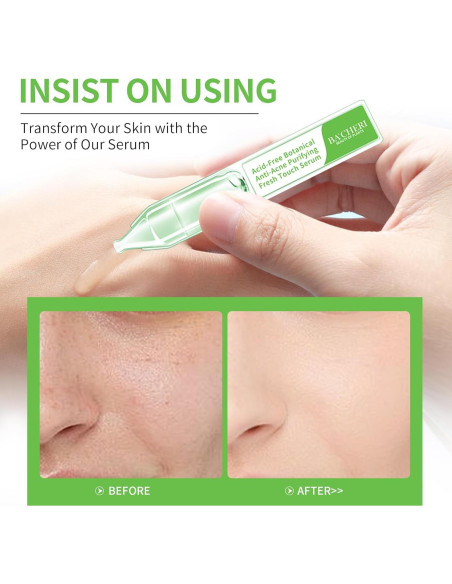 Suero Facial Antiacné BACHERI - 30 Ampollas 1.2 ml - Sin Ácido Suero Facial Antiacné BACHERI - 30 Ampollas 1.2 ml - Sin Ácido