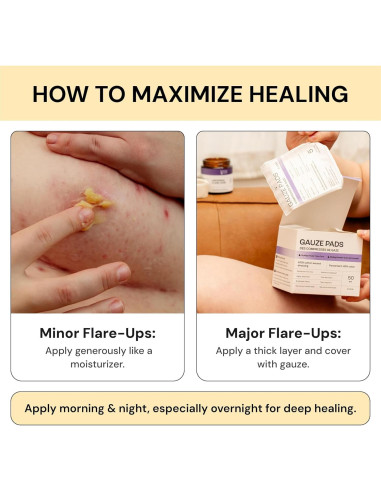 Cuidado de Piel MyMagicHealer 28.35 g - Alivio Natural Brotes