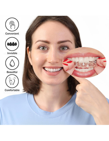 Férula Dental Nocturna Personalizada Candyying para Bruxismo