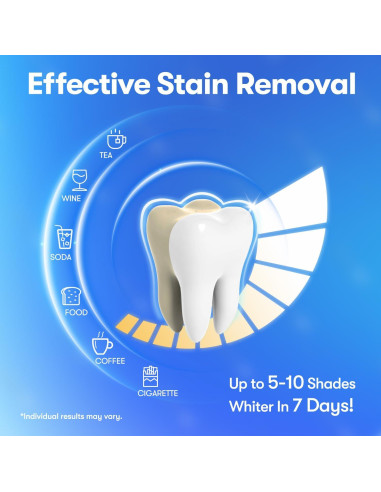 Kit de Blanqueamiento Dental MySmile 42 Tiras Sin Sensibilidad