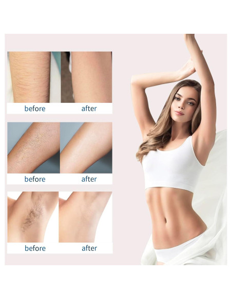 Crema Depilatoria Sin Dolor Smart Diary - 117g para Cuerpo y Axilas Crema Depilatoria Sin Dolor Smart Diary - 117g para Cuerpo y Axilas