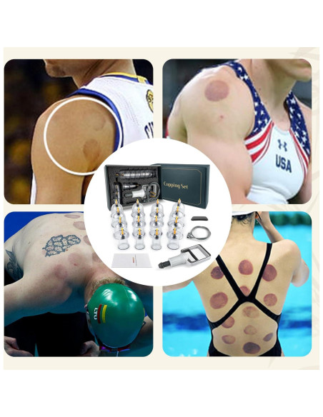 Kit de Ventosas DEFUNX - Set Profesional de 16 Copas para Masaje Kit de Ventosas DEFUNX - Set Profesional de 16 Copas para Masaje